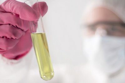 ​肌酐低是什么原因（血肌酐降低，一定是好事吗？听听肾科专家怎么说）