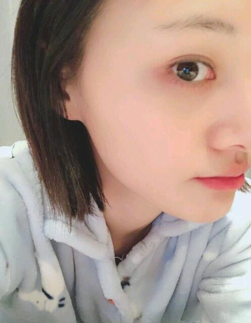 郑爽晒受伤素颜照,网友心疼:她怎么总是受伤啊!