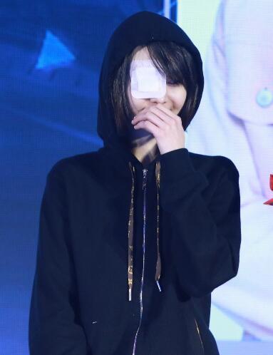 郑爽晒受伤素颜照,网友心疼:她怎么总是受伤啊!