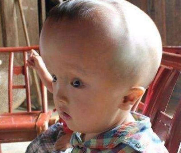 当年喝“三鹿奶粉”的大头娃娃,现在什么样了?