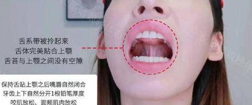 上口下巴(下巴与上颚衔接处疼)