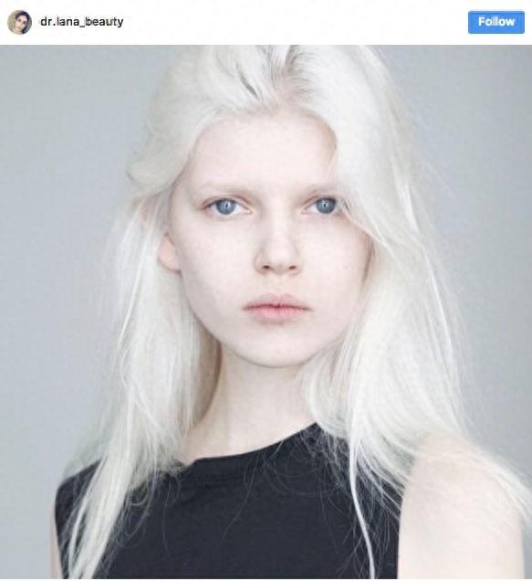 22张不同种族白化症之美的照片!