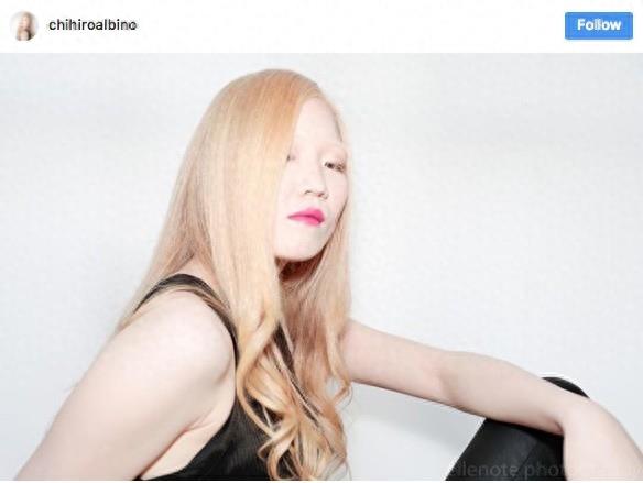 22张不同种族白化症之美的照片!