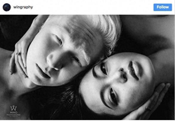 22张不同种族白化症之美的照片!