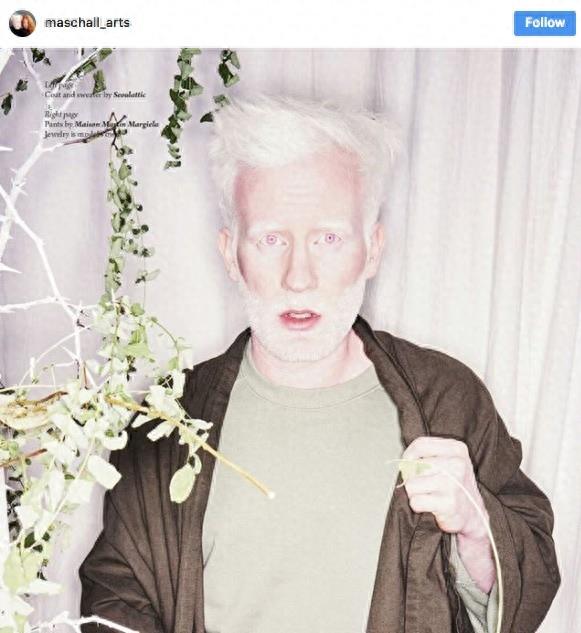 22张不同种族白化症之美的照片!