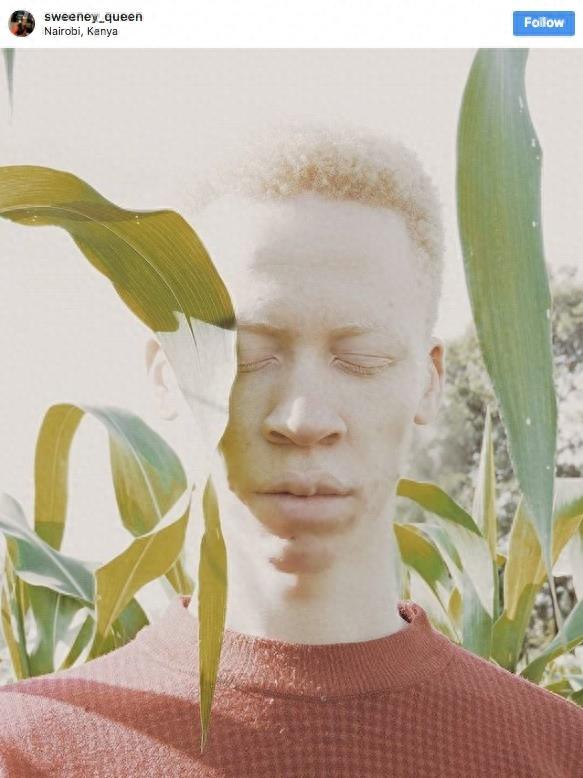 22张不同种族白化症之美的照片!