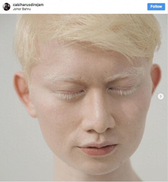 22张不同种族白化症之美的照片!