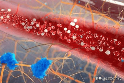 ​低密度脂蛋白增高是怎么回事儿吃什么药 低密度脂蛋白增高是什么