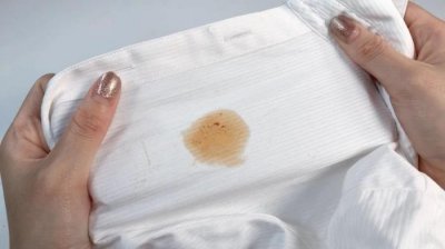 ​怎么去除衣服上的油渍（衣服染上的顽固油渍）