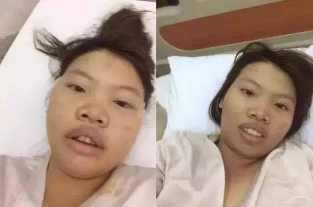 整容后的凤姐，延禧攻略整容脸,本文共（7669字）