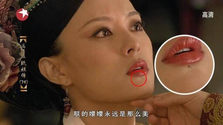 周冬雨下巴的疤痕怎么弄得「素颜的周冬雨下巴现3厘米疤痕而今才知道杨幂爱照半边脸的原因」