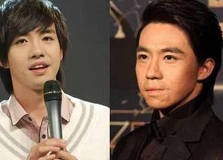 周冬雨下巴的疤痕怎么弄得「素颜的周冬雨下巴现3厘米疤痕而今才知道杨幂爱照半边脸的原因」