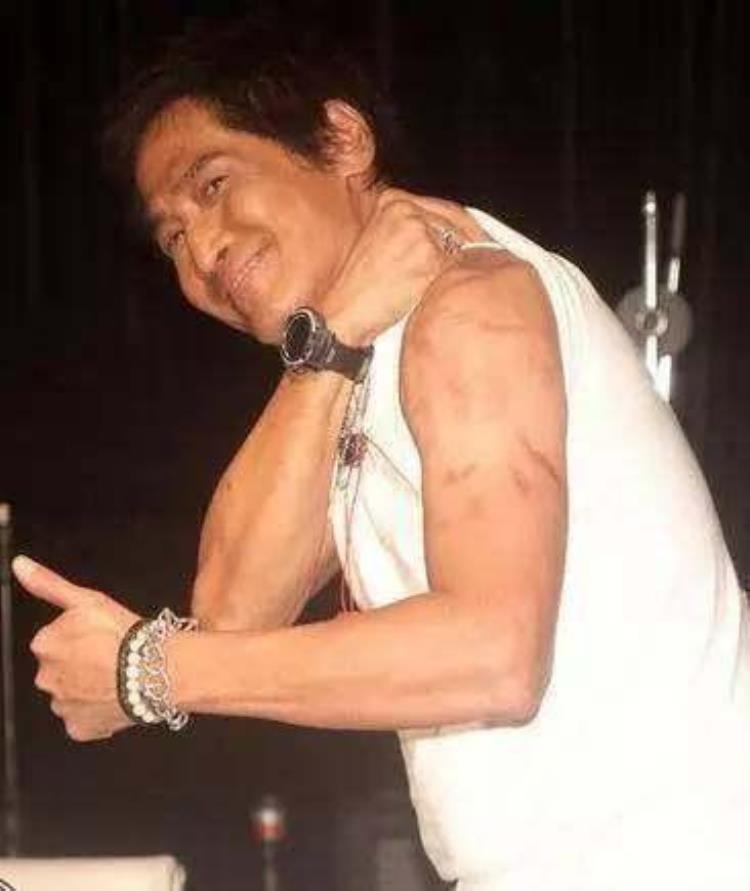 周冬雨下巴的疤痕怎么弄得「素颜的周冬雨下巴现3厘米疤痕而今才知道杨幂爱照半边脸的原因」