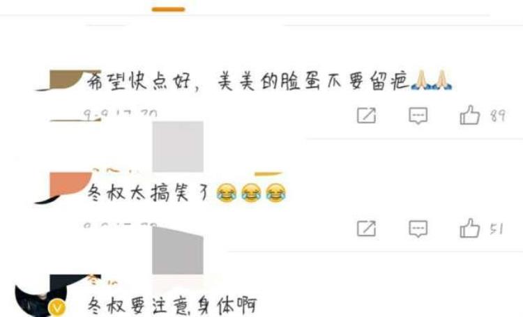 周冬雨下巴的疤痕怎么弄得「素颜的周冬雨下巴现3厘米疤痕而今才知道杨幂爱照半边脸的原因」