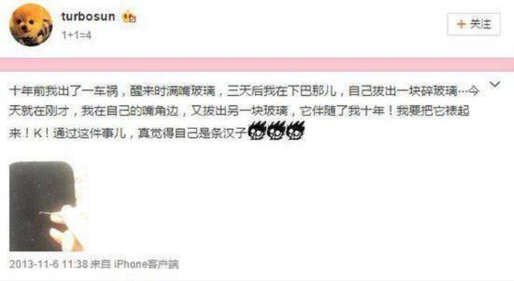 周冬雨下巴的疤痕怎么弄得「素颜的周冬雨下巴现3厘米疤痕而今才知道杨幂爱照半边脸的原因」