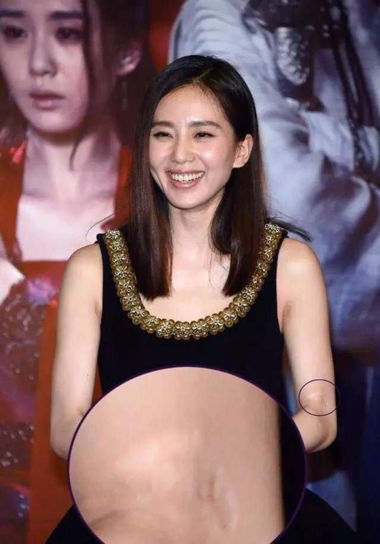 周冬雨下巴的疤痕怎么弄得「素颜的周冬雨下巴现3厘米疤痕而今才知道杨幂爱照半边脸的原因」