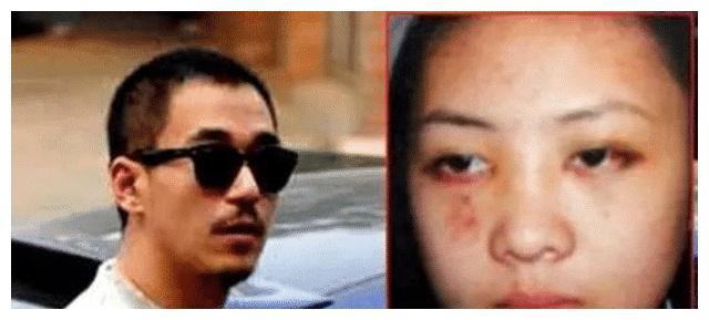 她为拍戏与老师发生关系？张默因此暴打她，时隔多年爆出真相