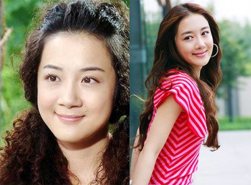 郑爽整形,郑爽以前旧照片(郑爽刚整容照片) 郑爽整形,郑爽以前旧照片(郑爽刚整容照片)