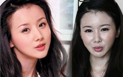 ​郑爽整形，郑爽以前旧照片(郑爽刚整容照片)